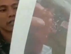 DI DUGA KORBAN MALPRAKTIK, 5 JARI BAYI INI TERANCAM PUTUS
